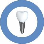 Our Mountain View, CA area patients know that diabetes may no longer be a reason to not treat missing teeth with dental implants.
